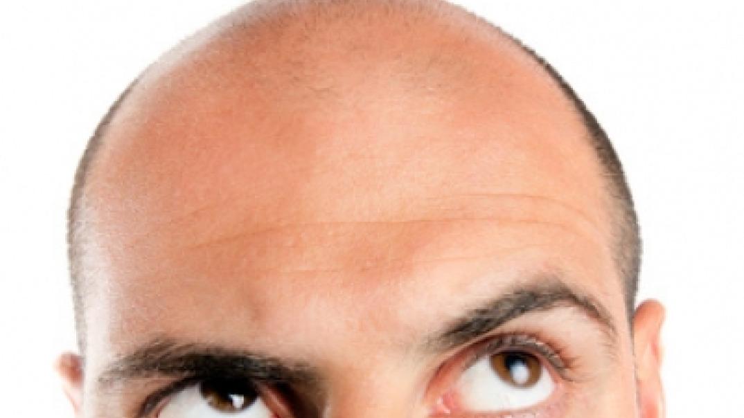 Tipps bei Haarausfall