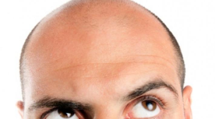 Tipps bei Haarausfall